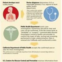 CDC technology advances promise better valley fever detection - The Bakersfield Californian