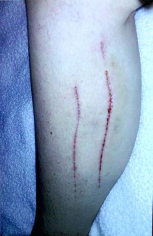 Woman sues owners of dog killed by her pit bulls