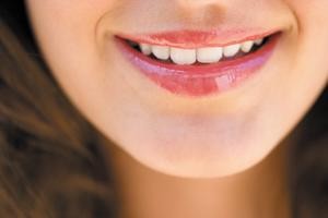 Smile Lifts  
