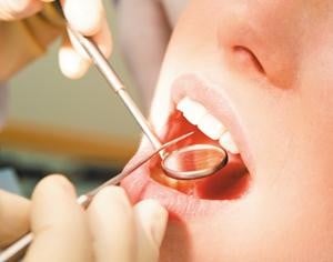 Oral Cancer Detection  