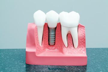 Oral Facial Surgery Institute and Implant Center  