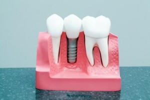 Oral Facial Surgery Institute and Implant Center  