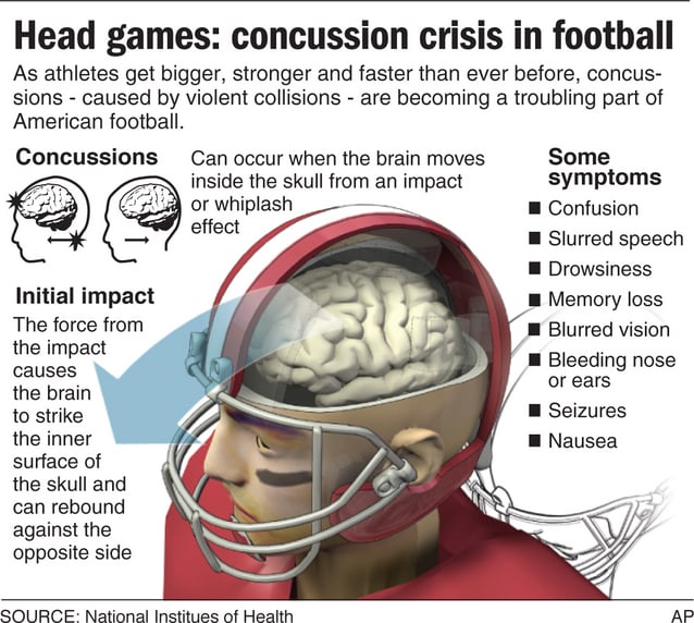 ‘concussion And What You Should Know About Sports And Brain Injuries Local News 