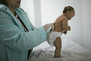 CDC confirms Zika virus causes microcephaly, other birth defects