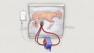 Hope for preemies as artificial womb helps tiny lambs grow