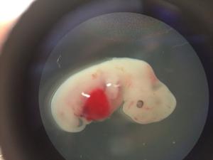 Scientists take first steps to growing human organs in pigs