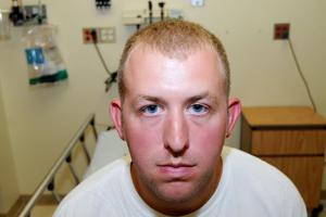 Photos of Darren Wilson's injuries released