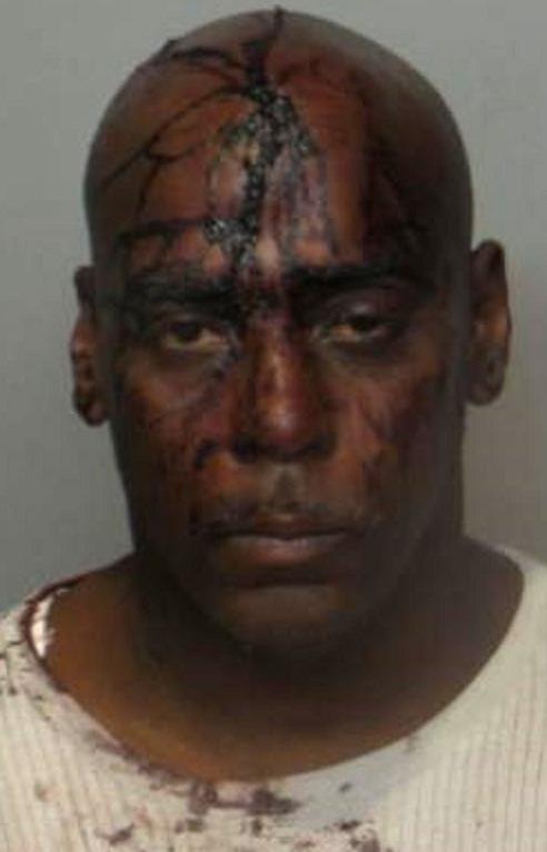 Appeals Court restores man's lawsuit over Ferguson jail beating