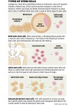 Stem cell