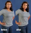 Bra intervention