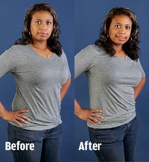 Bra intervention