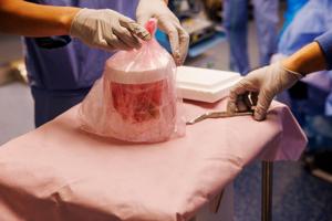 ENTER-MAN-GIVEN-GENETICALLY-MODIFIED-PIG-1-DPT.jpg