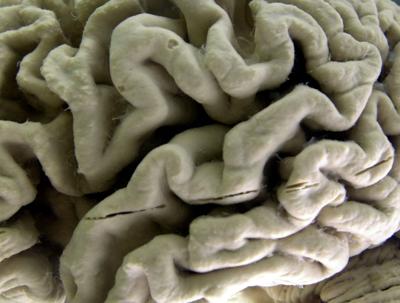 Alzheimers-Blood Test