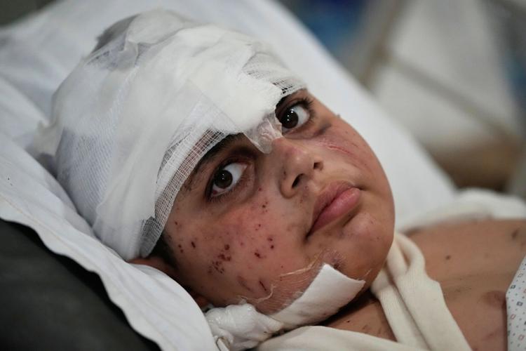 The top photos of the day by AP photojournalists