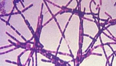 Pentagon: Anthrax Shipments Broader Than First Thought