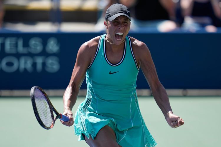 APTOPIX US Open Tennis