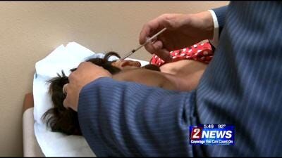 Botox for Migraines