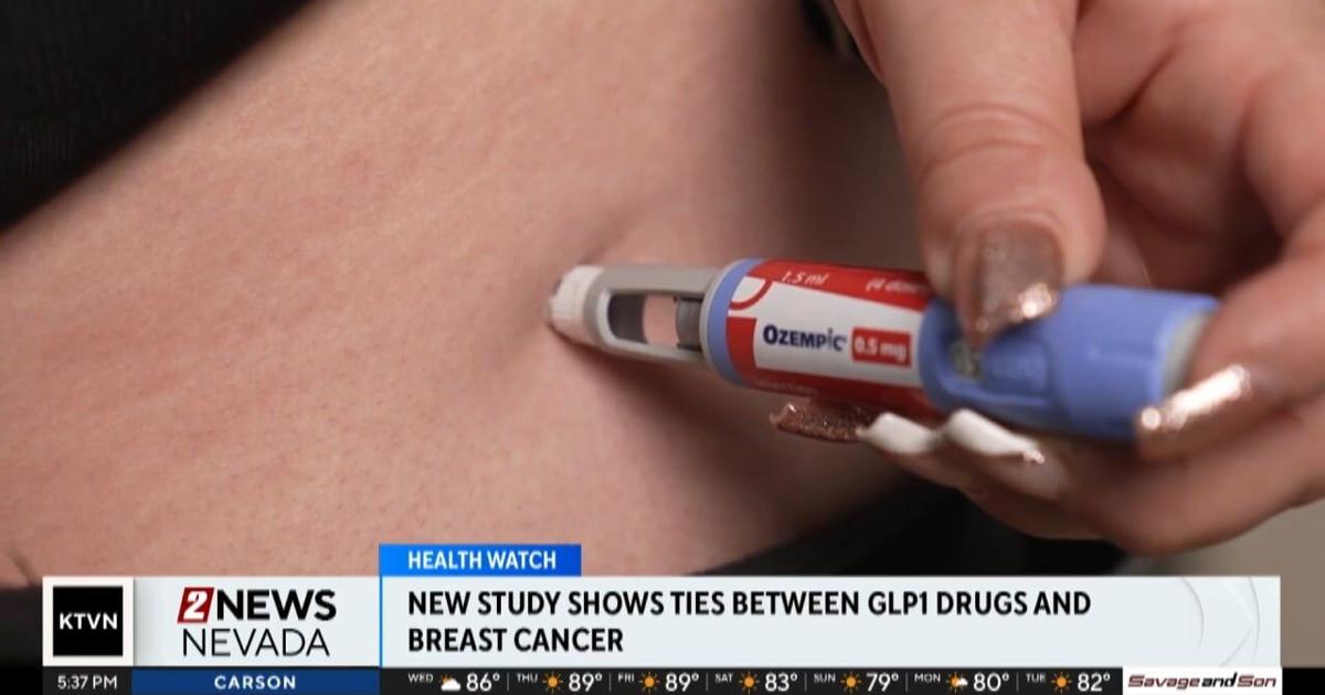 can you take glp 1 with breast cancer GLP 1 users less likely to develop breast cancer