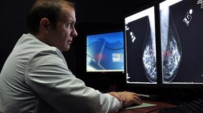 Breast cancer screening