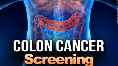 Colon Cancer Screening - MGN.jpg