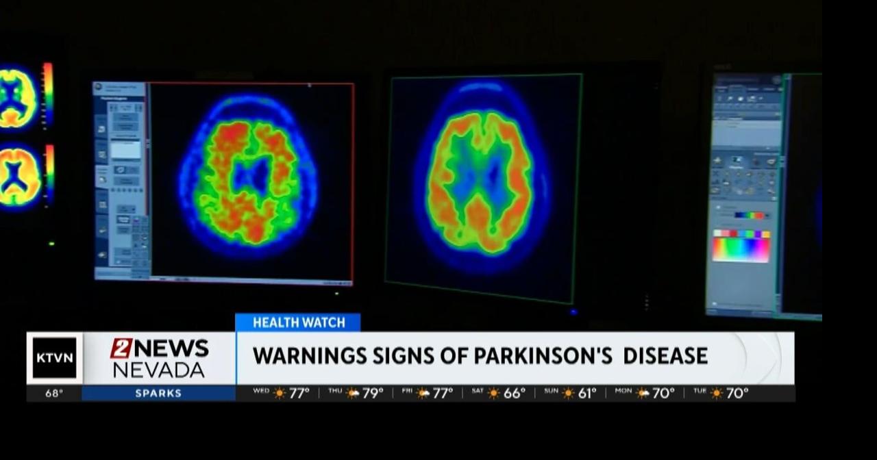 Health Watch: Parkinson