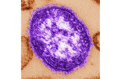 Measles Deaths