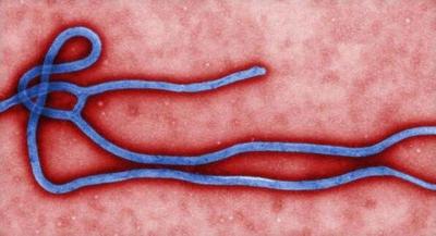 CDC: Ebola Confirmed in United States