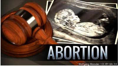 President Trump Moves Toward Tougher Abortion Restrictions