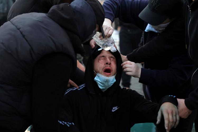 Tear gas, fires and clashes as anti-government unrest escalates in Albania, in photos