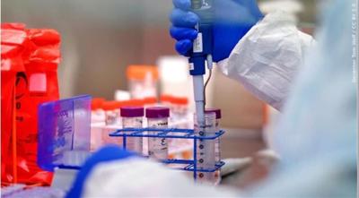 Lab test