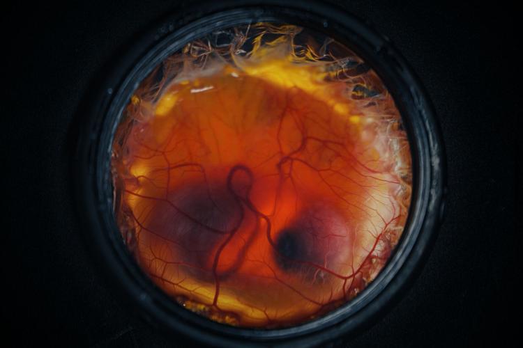De-extinction Artificial Eggs