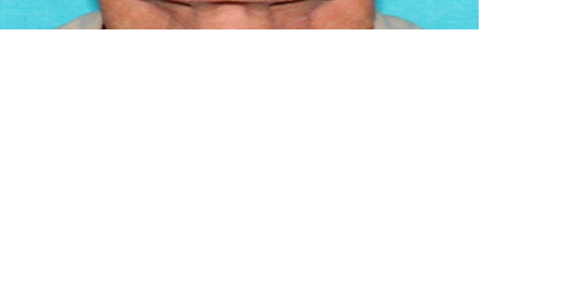 Washoe County Deputies Locate Missing 65-Year-Old - Vimarsana News
