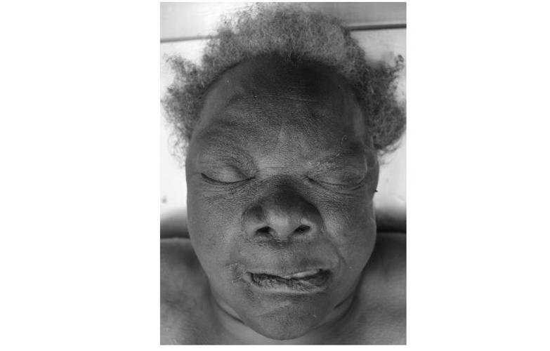 Woman who died