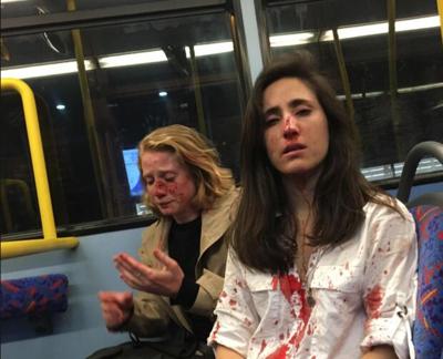 Lesbian Couple Attacked On London Bus