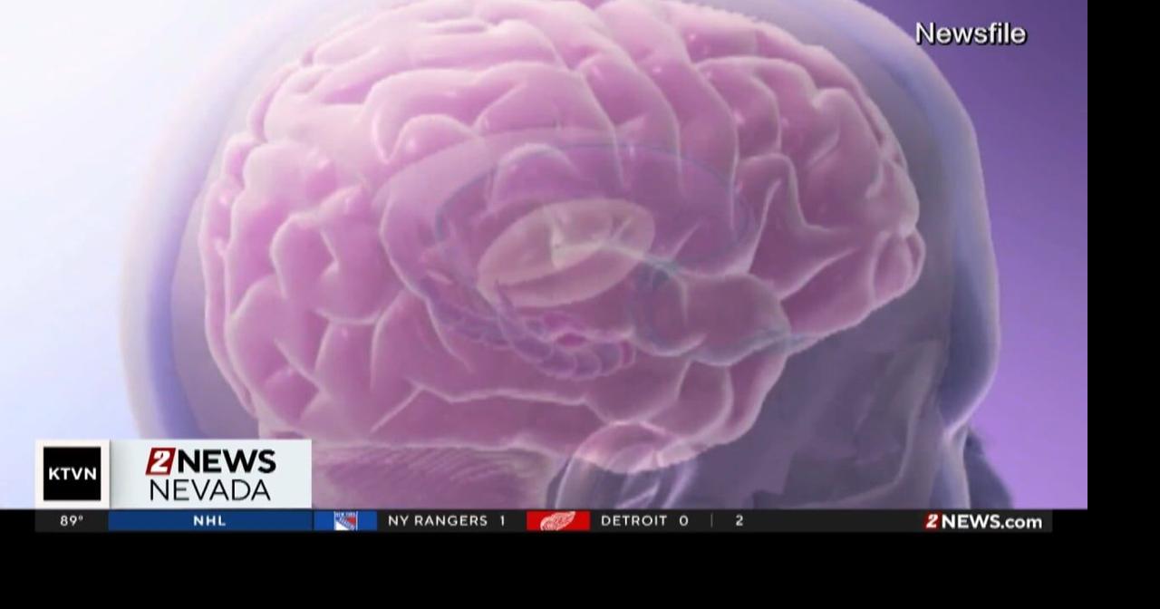 Spreading awareness for frontotemporal degeneration