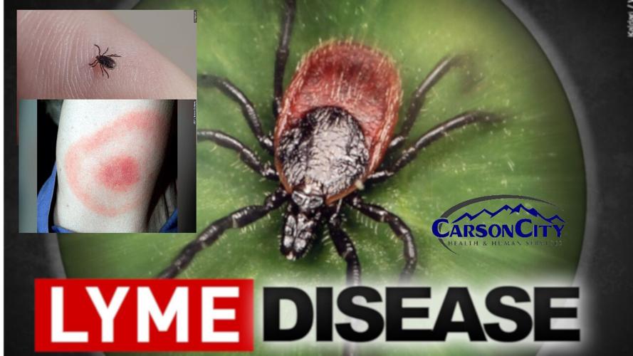 Health Officials confirm Lyme disease case in Carson City