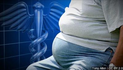 In A 24/7 Food Culture, Periodic Fasting Gains Followers