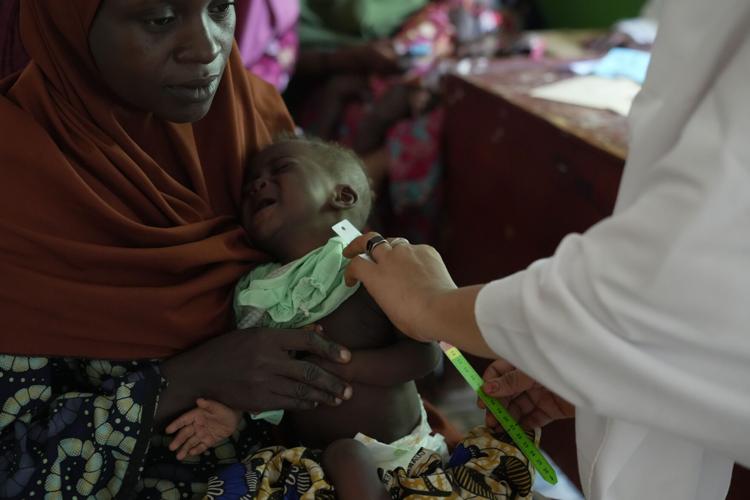 Nigeria Iran War Malnutrition