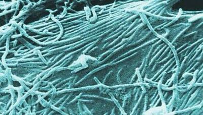 U.S. Warns Against Traveling to Ebola-Hit Countries