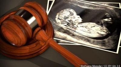 Abortion Legislature