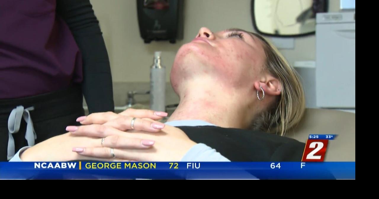 Ask The Doctor: Cleaning Acne Scars With Lasers | Ask The Doc | 2news.com
