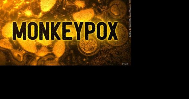 Southern Nevada Health District Reports First Monkeypox Case in Clark County - Vimarsana News
