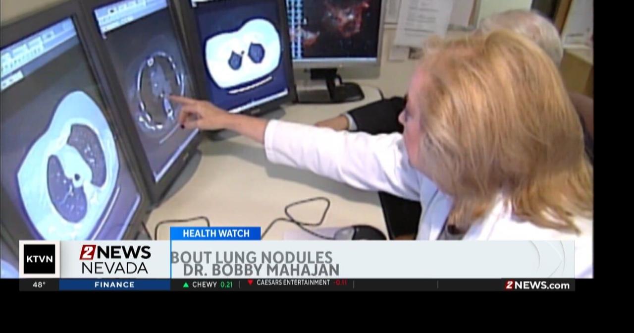 What to know about lung nodules