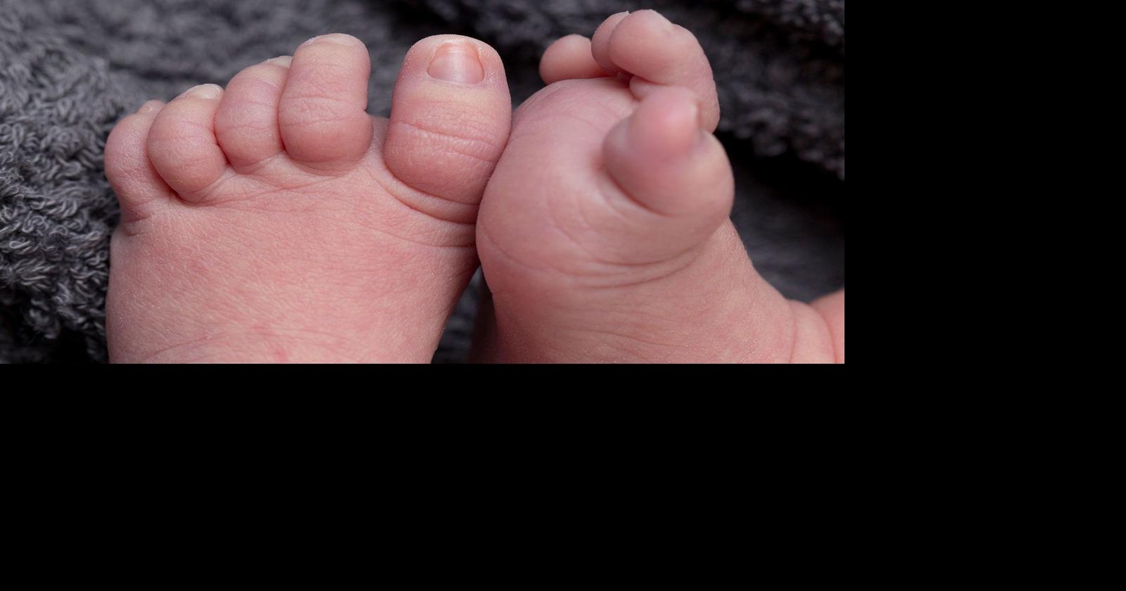 U.S. stillbirth rate improved last year, but progress is slow