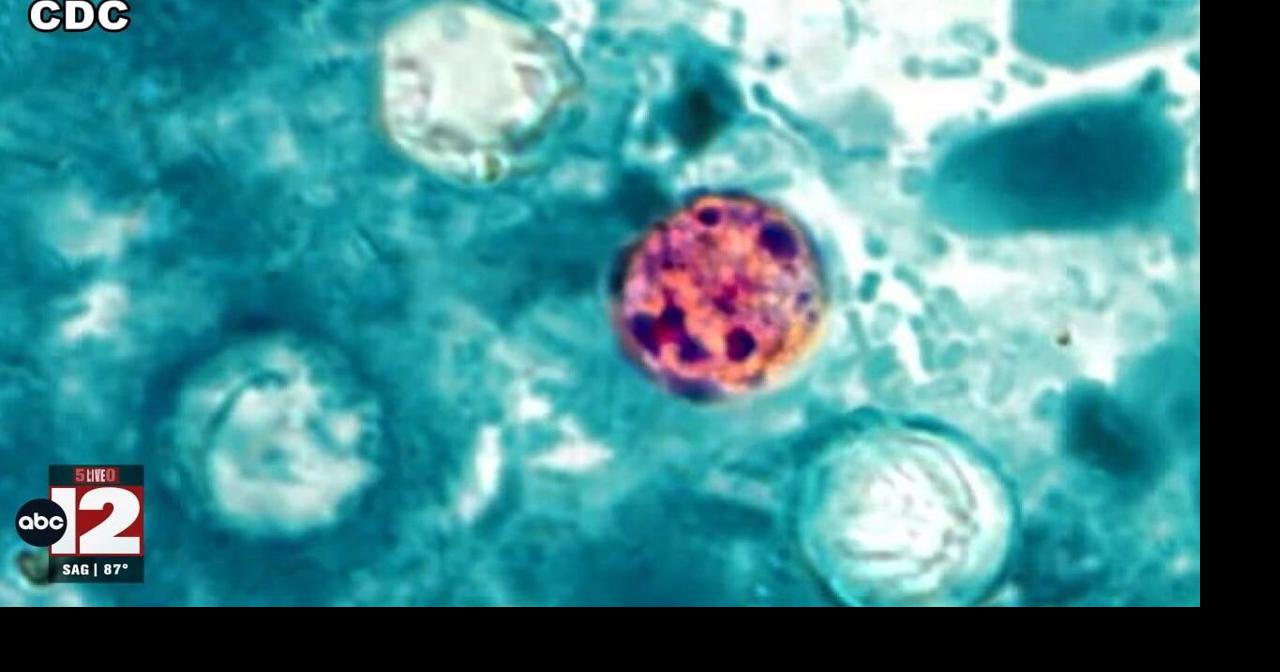 Michigan Tracks Near-1,000 Cyclosporiasis Cases on New Webpage