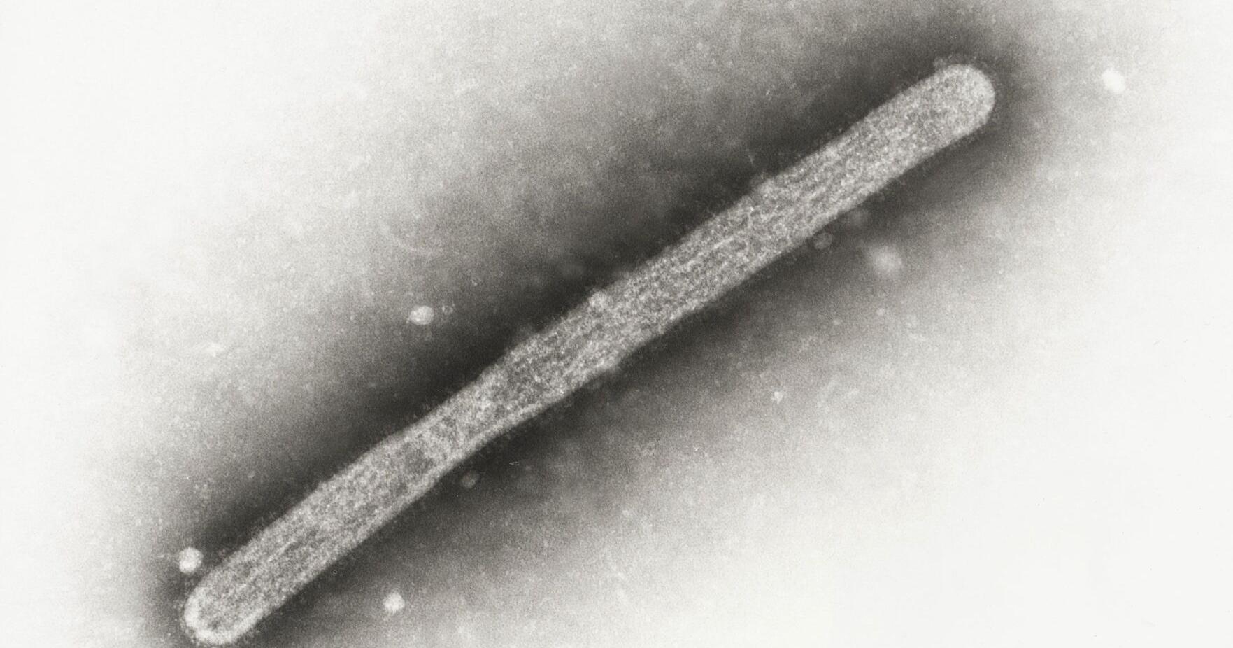 Michigan farm worker has second human case of bird flu this year - Vimarsana News