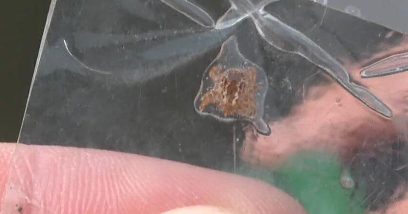 Staying safe and healthy this tick season - Vimarsana News