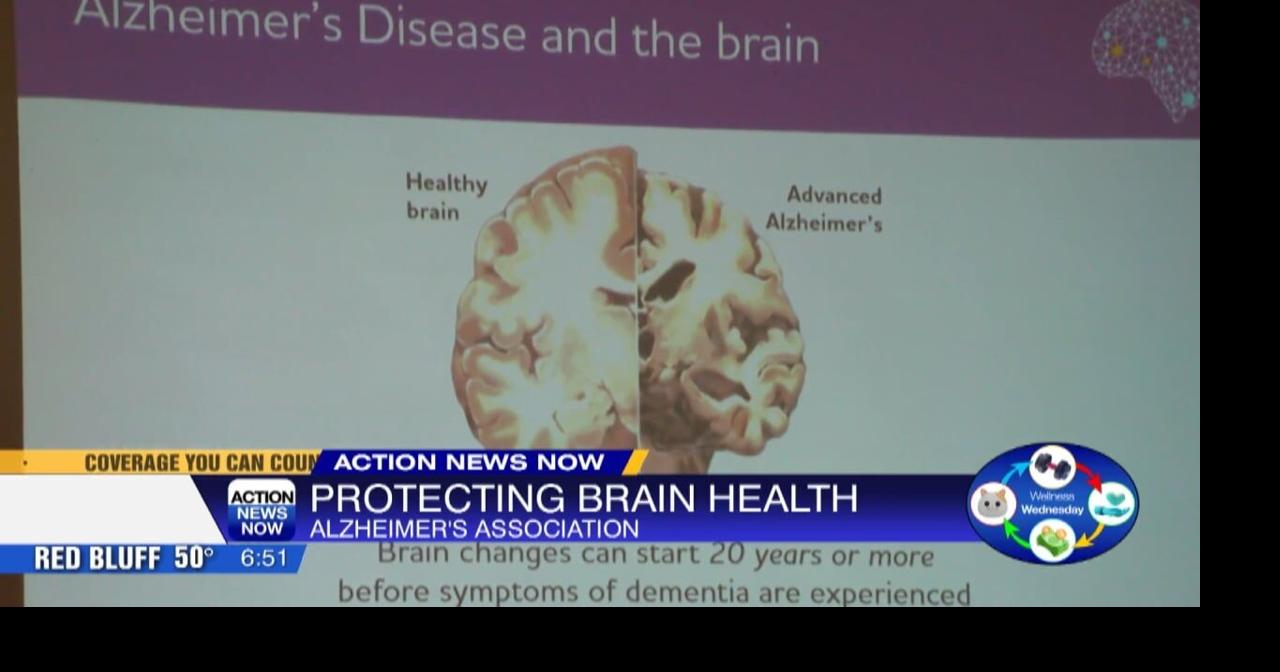 Alzheimer's Association brings brain health awareness event to Chico