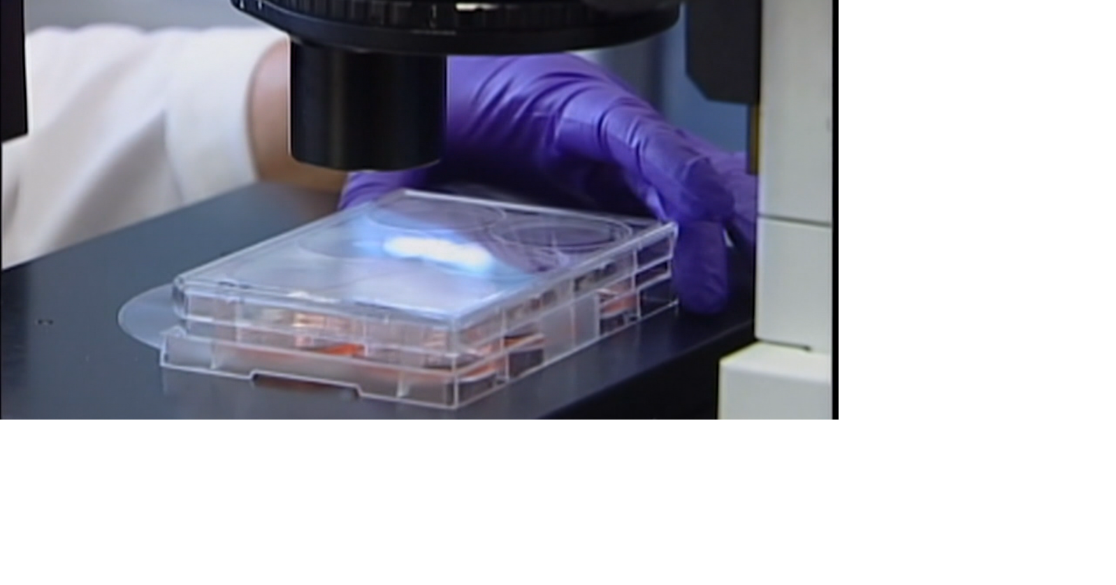 Stem cell therapy: The future of anti-aging & regenerative medicine ...