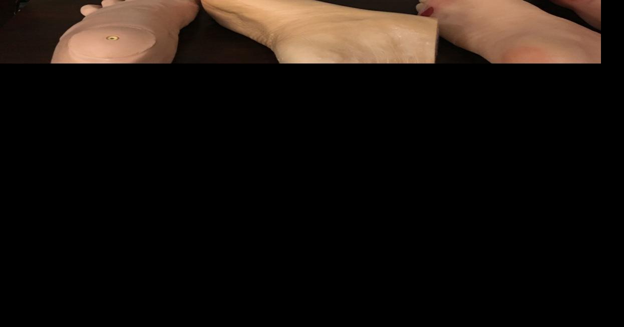 Healthcare Lions Donate Mirrors For Diabetic Foot Checks News